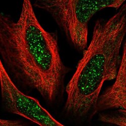 ACD Antibody, Novus Biologicals:Antibodies:Primary Antibodies